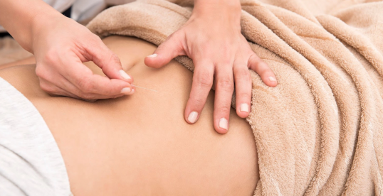 Acupuncture for fertility and pregnancy: What to know